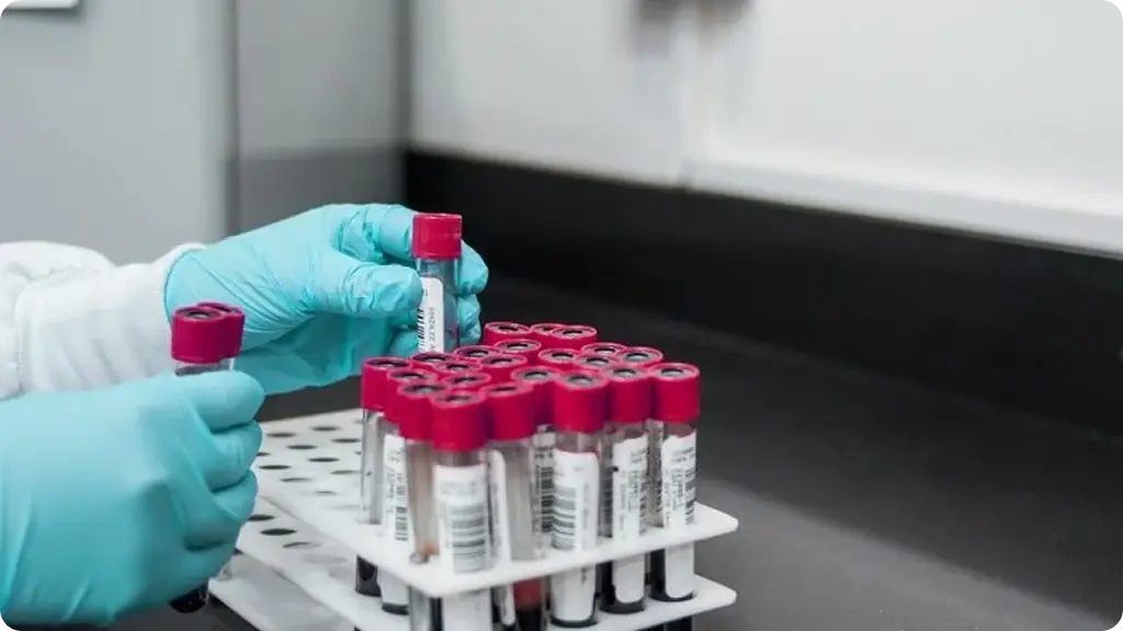 Proteomics boosts