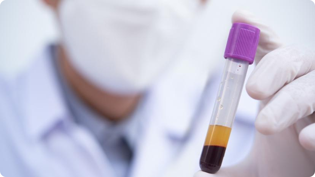 Proteomics boosts
